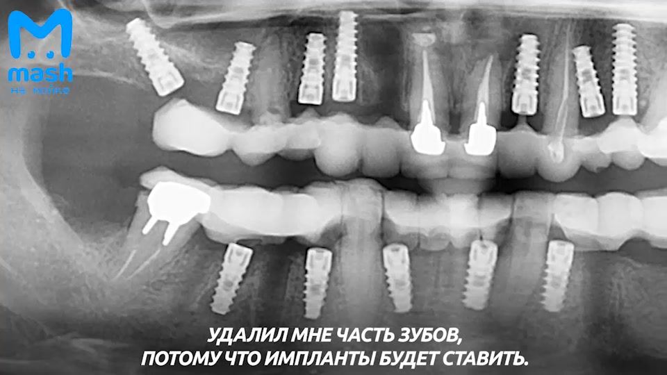 Новое видео:  «Петербурженка лишилась зубов после похода...